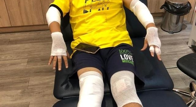 好惊险!58岁吴宗宪意外摔车,安全帽全碎,屁股肿得穿不下裤子
