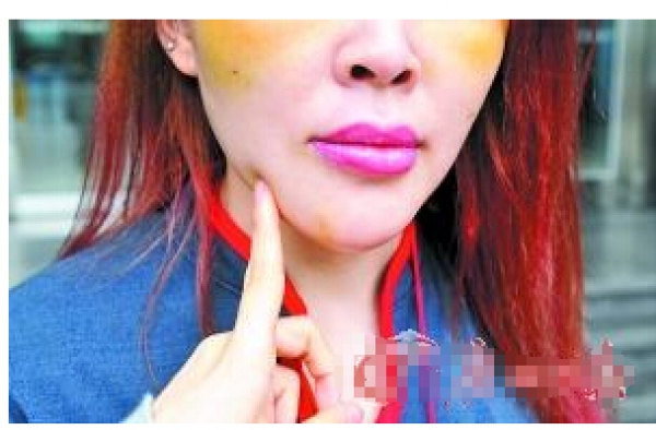 33岁女子整容成瘾:5年花30万整容十几次 痛并快乐着