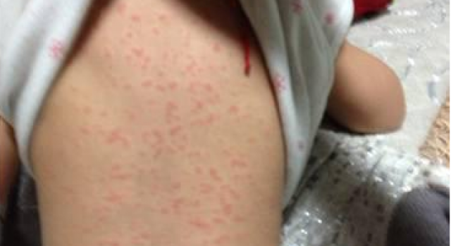 南昌12岁留守女孩疑在校遭多次强奸 染上性病致不孕