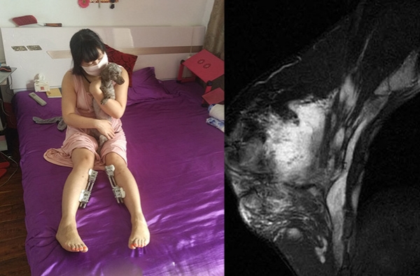 花钱买罪受!整形狂人手术200多次 乳房如石头面临切除