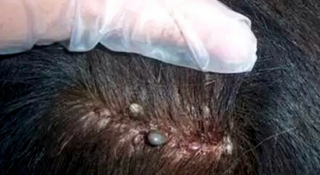 外婆用敌敌畏给孙女洗头致重度中毒 欲为其头发除虱