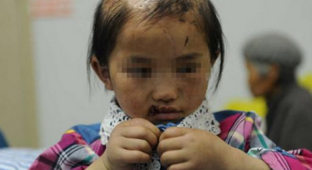 抑郁妈妈狠心虐女:针扎胸部套脖拴床致死 二审获刑2年