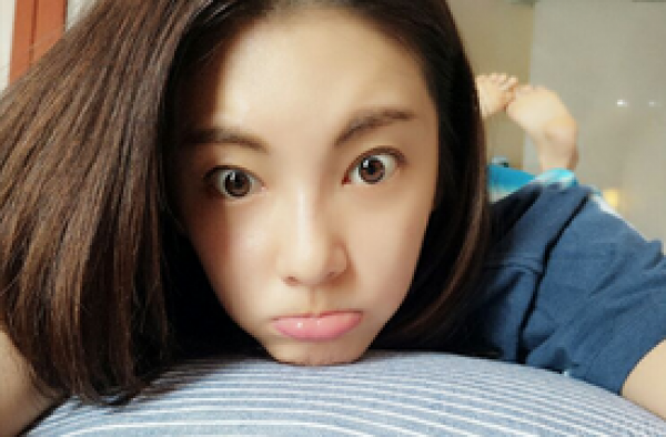 张雨绮美腿现淤青 明明可以靠脸却要靠演技