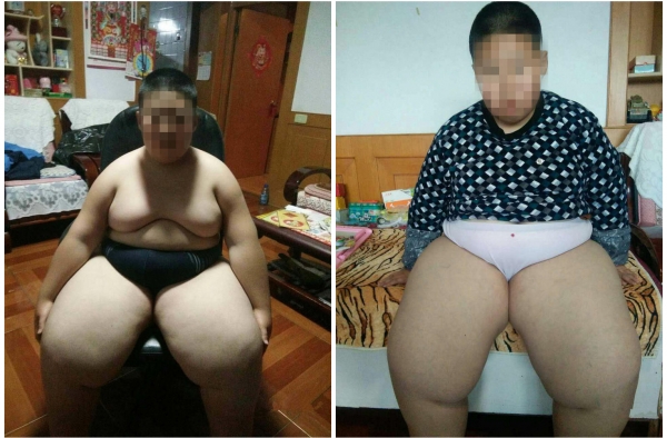 10岁小男孩体重182斤 坐着也能睡三年 单亲妈妈好烦恼