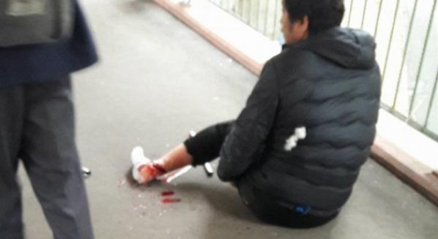 男子在港被匪徒斩断脚筋 400多万港元被抢走