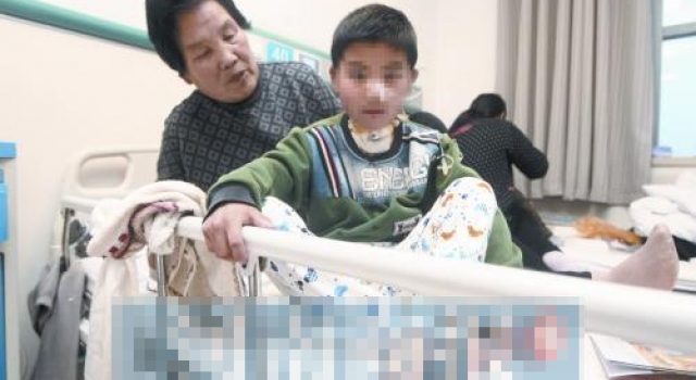可怜!藏獒咬断3岁男童的喉咙 4年来喝水吃饭只能用是注射
