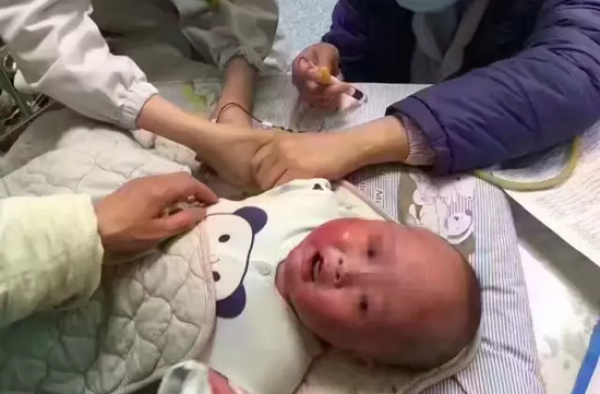 急寻粪便救救这5个月男婴！患儿母亲网上发帖求助