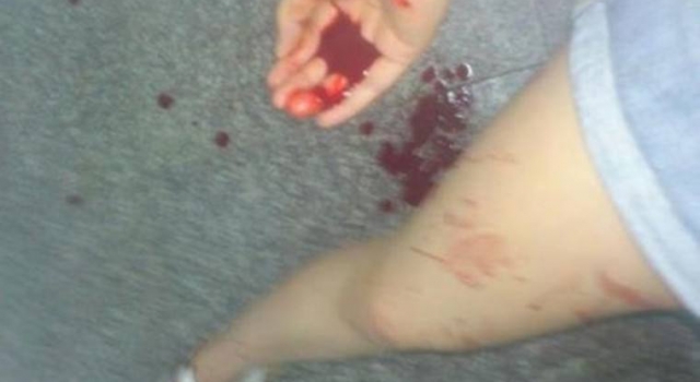 中学生早恋被发现分手 少女求和好被拒绝后捅伤男友