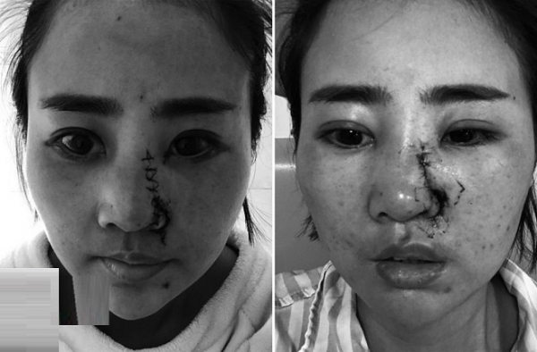 丽江女游客被打毁容案件宣判 丽江女游客被打事件始末