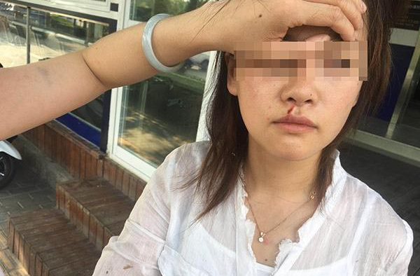 滴滴司机打伤乘客,司机被吐口水侮辱人被扇耳光