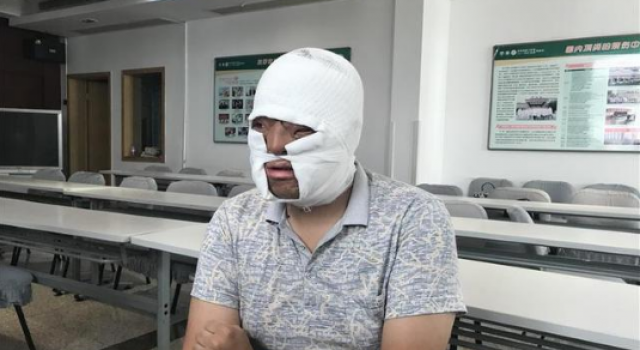 武汉小伙成功换脸 人生即将脱胎换骨？