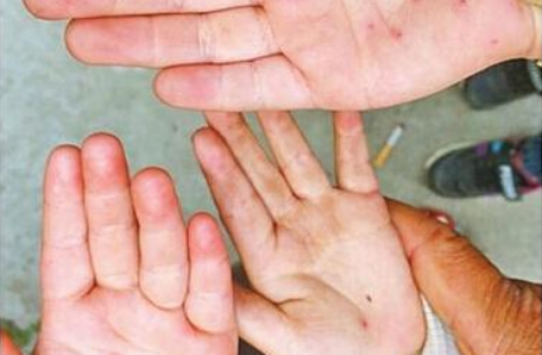 天津幼教针扎幼儿是怎么回事?现在幼儿园都这样管教?