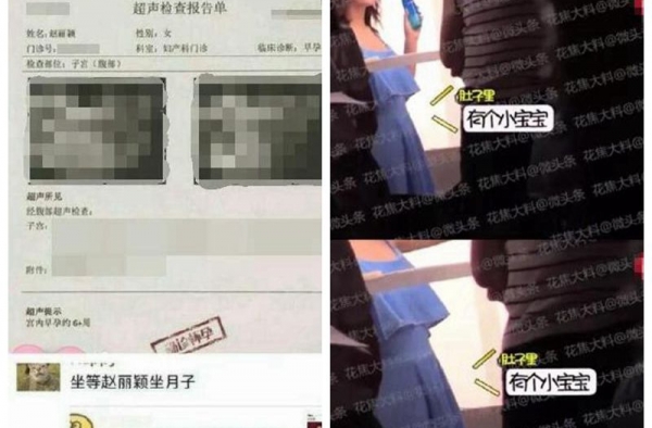 疑似赵丽颖怀孕六周B超照曝光 工作人员这样回应