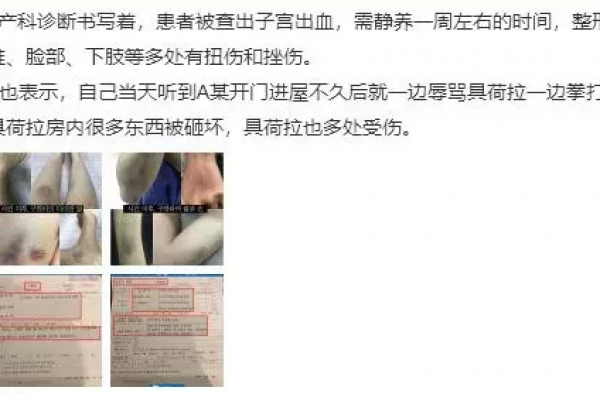 具荷拉家暴事件升级 具荷拉前男友将移送检察院