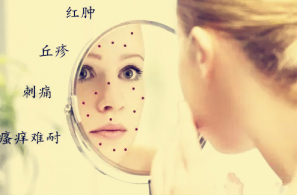 怎么把脸上的激素排完 那激素脸应该怎么治疗
