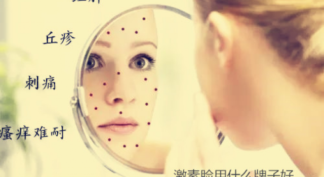 激素脸用什么牌子好 推荐适合激素脸的护肤品牌