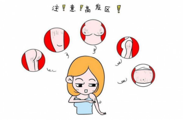 去鸡皮肤用什么好 用了它以后就不必再遮遮掩掩了