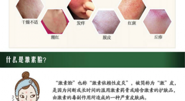 激素脸擦什么药好得快?一旦得了激素脸怎么快速代谢掉