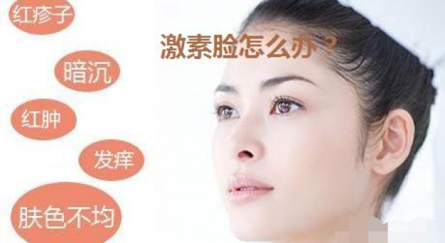 什么是激素脸怎么治疗？激素脸能彻底治愈吗
