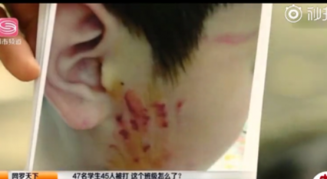 无法无天！47名学生45人被打 老实的孩子这么欺负人？