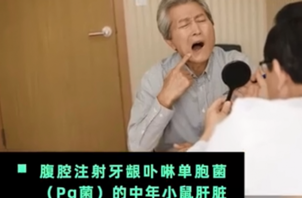 牙周炎可能导致阿尔茨海默病 网友：牙医要大赚一笔了