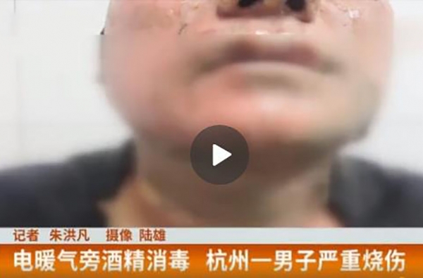 酒精消毒后烤电暖气全身着火 网友：消毒也要注意防火