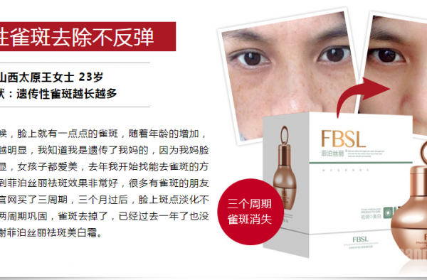 祛斑产品哪款最有效果（这款效果好的超乎您想象）