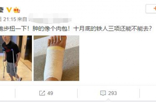 59岁庾澄庆跑步扭伤，脚肿得像肉包，豪宅一角曝光还自带电梯？