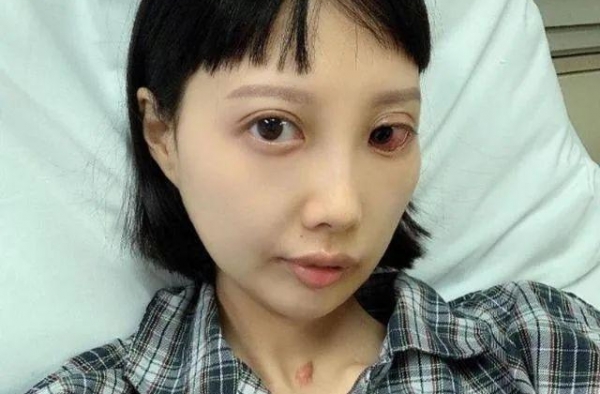 病情恶化！31岁香港女星抗癌8年，器官衰竭、几近面目瘫痪