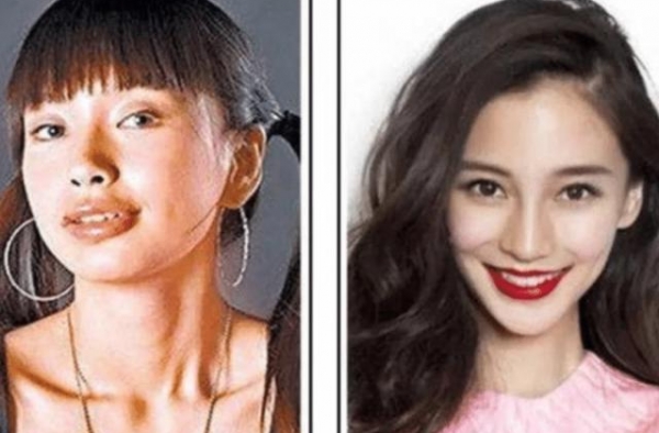 傅园慧整牙后判若两人，网友：看来baby没有说谎