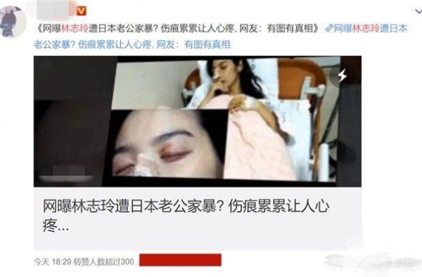 林志玲获老公做应援板 黑泽良平直呼：我的真爱