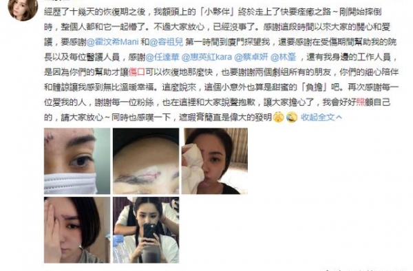 阿娇缝线伤口照首曝光，医生叹激光去疤也难复原