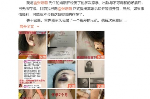 张培萌妻子称被家暴后续：男方发争吵视频力证清白，网友吃瓜看戏