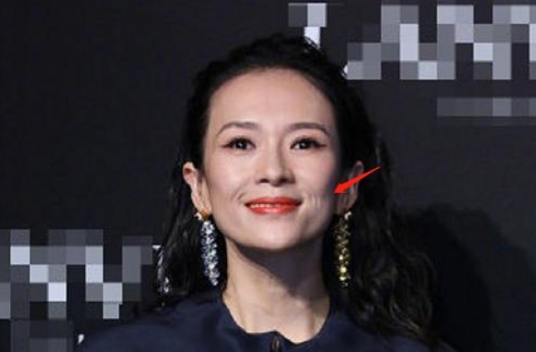 章子怡二胎后首现身，难掩皱纹疑秃头显老态，二胎致元气大伤？