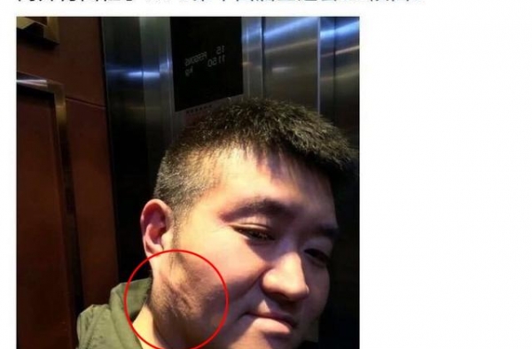 著名相声演员苗阜被打 血气方刚的同行玉浩为何打人 细思极恐