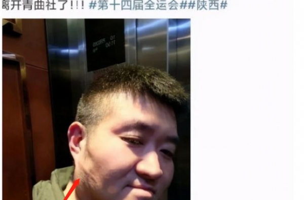 著名相声演员苗阜被打！脸上伤痕严重，施暴者曾遭郭德纲力捧