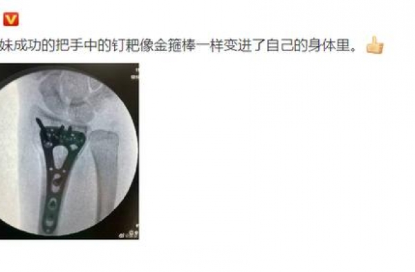 在观众面前是战狼，在谢楠面前又是卖萌又是索吻，吴京有两副面孔