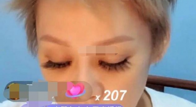 48岁宁静直播坑人？自称用刮痧板刮掉脸上的斑，网友：误人子弟